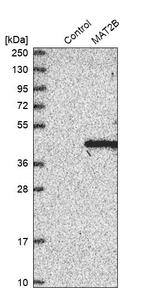 MAT2B Antibody in Western Blot (WB)