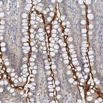 MAT2B Antibody in Immunohistochemistry (IHC)