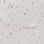 MAT2B Polyclonal Antibody