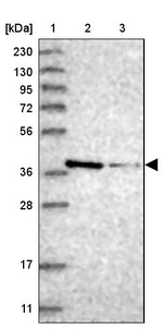 MAT2B Antibody in Western Blot (WB)