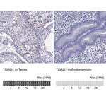 TDRD1 Polyclonal Antibody