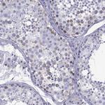 TDRD1 Antibody in Immunohistochemistry (IHC)