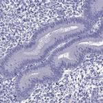 TDRD1 Antibody in Immunohistochemistry (IHC)