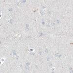 Myotilin Antibody in Immunohistochemistry (IHC)