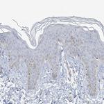 Myotilin Antibody in Immunohistochemistry (IHC)