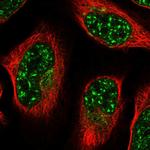 ZNF527 Polyclonal Antibody