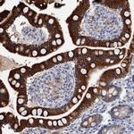 ZNF527 Antibody in Immunohistochemistry (Paraffin) (IHC (P))