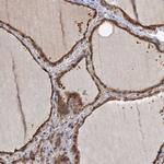 ZNF527 Polyclonal Antibody