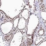 POLR2H Antibody in Immunohistochemistry (IHC)