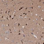 EXTL1 Polyclonal Antibody