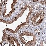 FAM53B Polyclonal Antibody