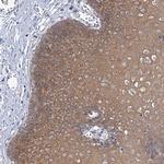 MBLAC2 Antibody in Immunohistochemistry (Paraffin) (IHC (P))