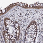 MBLAC2 Antibody in Immunohistochemistry (Paraffin) (IHC (P))