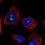 LRRC23 Polyclonal Antibody