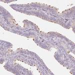 LRRC23 Antibody in Immunohistochemistry (Paraffin) (IHC (P))