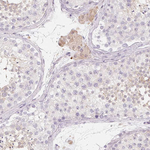 LRRC23 Antibody in Immunohistochemistry (Paraffin) (IHC (P))