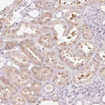 LRRC23 Antibody in Immunohistochemistry (Paraffin) (IHC (P))