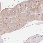 LRRC23 Antibody in Immunohistochemistry (Paraffin) (IHC (P))