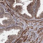 HECTD2 Polyclonal Antibody