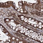 HECTD2 Antibody in Immunohistochemistry (Paraffin) (IHC (P))