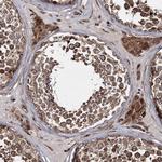HECTD2 Antibody in Immunohistochemistry (Paraffin) (IHC (P))