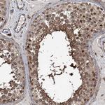 Vasculin Antibody in Immunohistochemistry (Paraffin) (IHC (P))