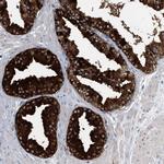 TRAPPC13 Antibody in Immunohistochemistry (Paraffin) (IHC (P))