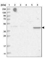 TRAPPC13 Antibody in Western Blot (WB)