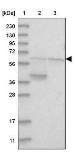 A1CF Antibody in Western Blot (WB)