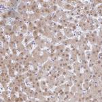 A1CF Antibody in Immunohistochemistry (IHC)