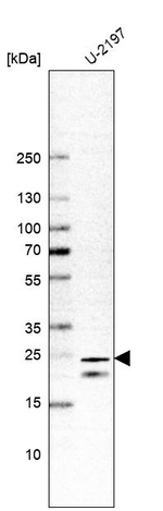 TMEM9B Antibody in Western Blot (WB)