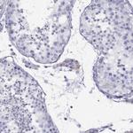 LRIT2 Antibody in Immunohistochemistry (Paraffin) (IHC (P))