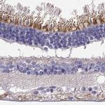 LRIT2 Antibody in Immunohistochemistry (IHC)