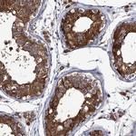 DYDC1 Antibody in Immunohistochemistry (Paraffin) (IHC (P))