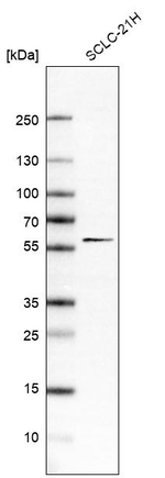 KBTBD4 Antibody in Western Blot (WB)
