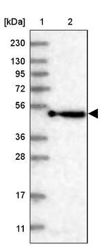 KBTBD4 Antibody in Western Blot (WB)