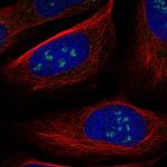 WDR36 Polyclonal Antibody