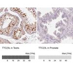 TTC23L Antibody in Immunohistochemistry (IHC)