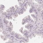 TTC23L Antibody in Immunohistochemistry (IHC)