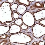SERGEF Antibody in Immunohistochemistry (IHC)