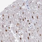 VWA5A Antibody in Immunohistochemistry (Paraffin) (IHC (P))