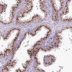 VWA5A Antibody in Immunohistochemistry (Paraffin) (IHC (P))