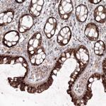 ANAPC16 Antibody in Immunohistochemistry (Paraffin) (IHC (P))