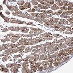 NAT11 Antibody in Immunohistochemistry (Paraffin) (IHC (P))