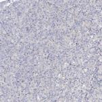 NAT11 Antibody in Immunohistochemistry (Paraffin) (IHC (P))