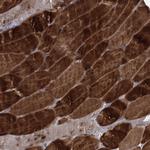 NAT11 Antibody in Immunohistochemistry (Paraffin) (IHC (P))