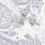 NAT11 Antibody in Immunohistochemistry (Paraffin) (IHC (P))