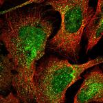 DEPP Antibody in Immunocytochemistry (ICC/IF)
