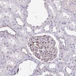 DEPP Antibody in Immunohistochemistry (Paraffin) (IHC (P))
