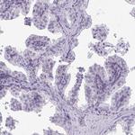DEPP Antibody in Immunohistochemistry (Paraffin) (IHC (P))